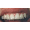5 Day Teeth FX Making Course